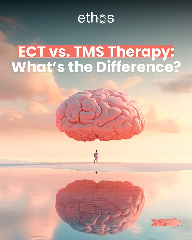 Ethos Clinic educational carousel post: ECT vs TMS Therapy explainer
